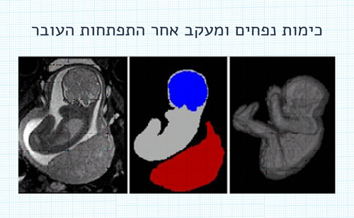 הערכה כמותית של התפתחות העובר | איכילוב