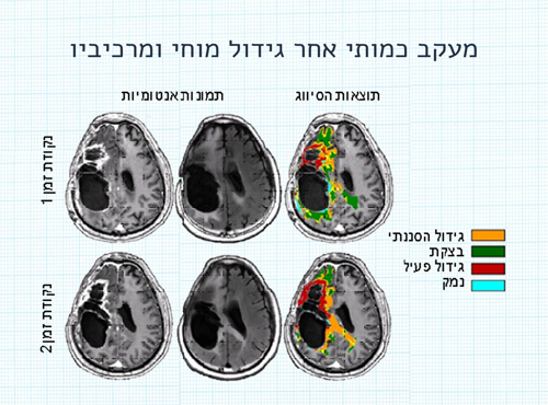 TUMORS1